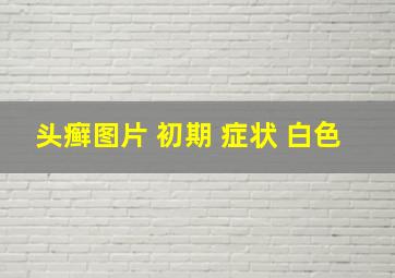 头癣图片 初期 症状 白色